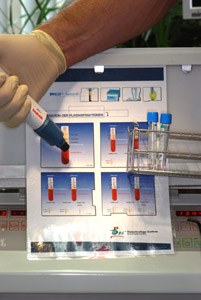 Zahnarzt München: Knochenwachstumsproteine aus Blutzellen zur schnellen Heilung von Zahnimplantaten