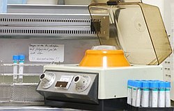 Zahnarzt München: Wachstumsproteine aus Eigenblut zur schnellen Knochenbildung Zahnarzt München:Wachstumsproteine aus Eigenblut zur schnellen Knochenbildung