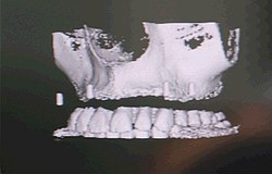 Zahnarzt München: Hightech Neuigkeiten Zahnarzt München: Übersicht Hightech für unsere Patienten