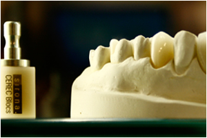 schöner ästethischer Zahnersatz aus Zirkon