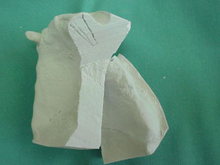 Zahnimplantat München: gute Planung beugt Mißerfolgen vor