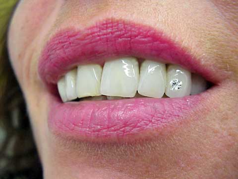 Echte Brillianten entfachen ein Feuer