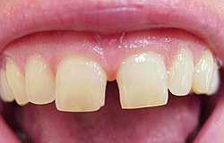 Zahnarzt Mnchen: Ein Probeauftrag vor dem endgltigen Schlieen macht den Patienten sicher