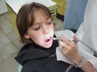 Zahnarzt Mnchen: Die Ansthesie (Schmerzfreiheit) mittels Injekton fhrt zur Lokalansthesie. Mit dieser kann man vllig schmerzfrei behandlen.