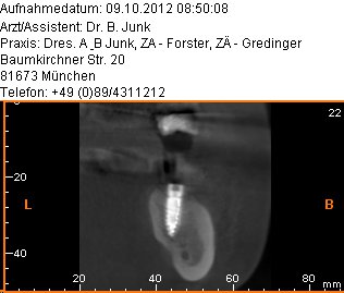 Zahnarzt München Röntgenaufnahme