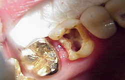 Zahnarzt München: Sinn Prinzip der Wurzelbehandlung Zahnarzt München: Sinn Prinzip der Wurzelbehandlung